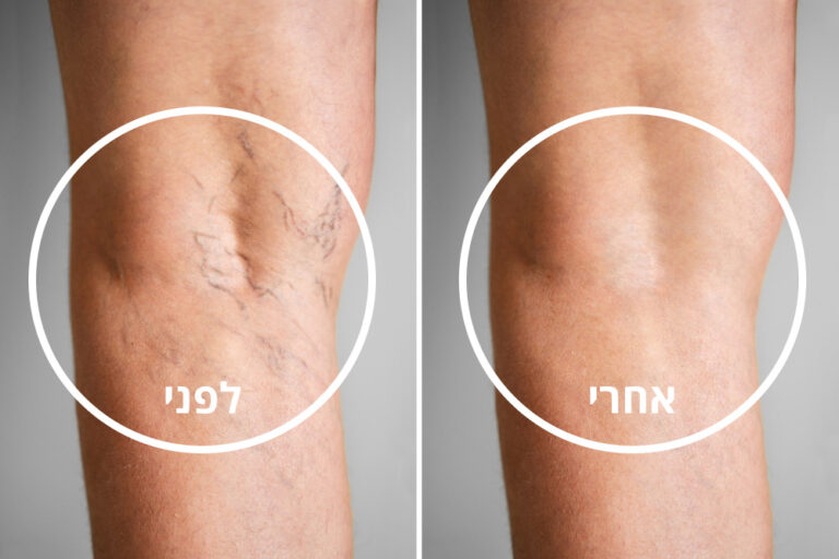 before-n-after